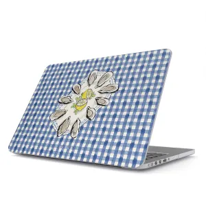 Today's Special - Macbook Case